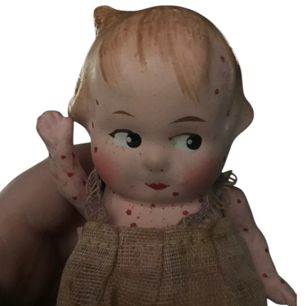 Antique Bisque Doll with Big Eyes Red dot Measles on Body and Burlap Gown Cloth!